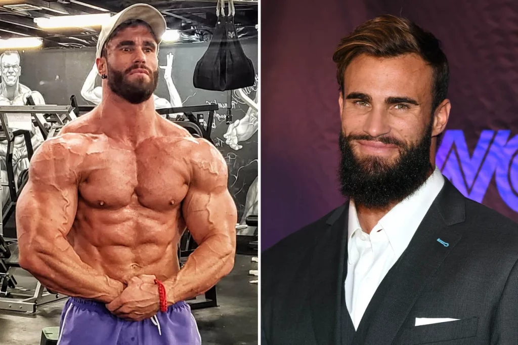 Calum von Moger Injury Update